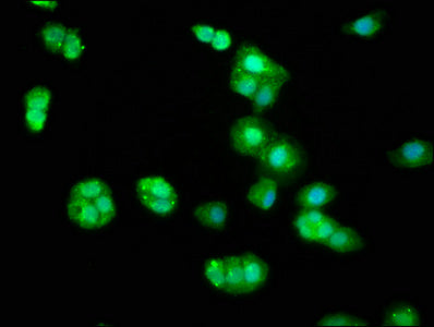 Immunofluorescence staining of HepG2 cells with BIN2 Antibody at 1:33, counter-stained with DAPI. The cells were fixed in 4% formaldehyde, permeabilized using 0.2% Triton X-100 and blocked in 10% normal Goat Serum. The cells were then incubated with the antibody overnight at 4°C. The secondary antibody was Alexa Fluor 488-congugated AffiniPure Goat Anti-Rabbit IgG(H+L).