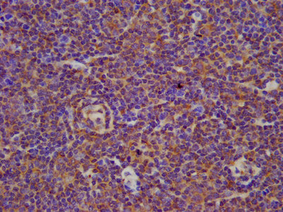 IHC image of the antibody diluted at 1:100 and staining in paraffin-embedded human lymph node tissue performed on a Leica BondTM system. After dewaxing and hydration, antigen retrieval was mediated by high pressure in a citrate buffer (pH 6.0). Section was blocked with 10% normal goat serum 30min at RT. Then primary antibody (1% BSA) was incubated at 4°C overnight. The primary is detected by a biotinylated secondary antibody and visualized using an HRP conjugated SP system.