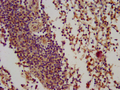 IHC image of BIN2 Antibody diluted at 1:100 and staining in paraffin-embedded human spleen tissue performed on a Leica BondTM system. After dewaxing and hydration, antigen retrieval was mediated by high pressure in a citrate buffer (pH 6.0). Section was blocked with 10% normal goat serum 30min at RT. Then primary antibody (1% BSA) was incubated at 4°C overnight. The primary is detected by a biotinylated secondary antibody and visualized using an HRP conjugated SP system.