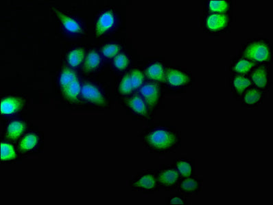 Immunofluorescence staining of Hela cells with BLVRB Antibody at 1:100, counter-stained with DAPI. The cells were fixed in 4% formaldehyde, permeabilized using 0.2% Triton X-100 and blocked in 10% normal Goat Serum. The cells were then incubated with the antibody overnight at 4°C. The secondary antibody was Alexa Fluor 488-congugated AffiniPure Goat Anti-Rabbit IgG(H+L).
