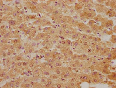 IHC image of BLVRB Antibody diluted at 1:300 and staining in paraffin-embedded human liver tissue performed on a Leica BondTM system. After dewaxing and hydration, antigen retrieval was mediated by high pressure in a citrate buffer (pH 6.0). Section was blocked with 10% normal goat serum 30min at RT. Then primary antibody (1% BSA) was incubated at 4°C overnight. The primary is detected by a biotinylated secondary antibody and visualized using an HRP conjugated SP system.