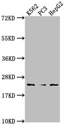 Western Blot | Positive WB detected in: K562 whole cell lysate, PC3 whole cell lysate, HepG2 whole cell lysate | All lanes: BLVRB antibody at 1:2000 | Secondary | Goat polyclonal to rabbit IgG at 1/50000 dilution | Predicted band size: 23 kDa | Observed band size: 23 kDa