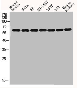 Western blot analysis of mouse-brain HELA KB SH-SY5Y 293T 3T3 Mouse-kidney lysis using GNL3L antibody.Rabbit anti-Human GNL3L Polyclonal Antibody