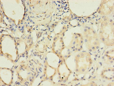Immunohistochemistry of paraffin-embedded human kidney tissue using the antibody at dilution of 1:100