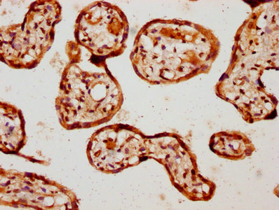 IHC image of BMPR1A Antibody diluted at 1:1000 and staining in paraffin-embedded human placenta tissue performed on a Leica BondTM system. After dewaxing and hydration, antigen retrieval was mediated by high pressure in a citrate buffer (pH 6.0). Section was blocked with 10% normal goat serum 30min at RT. Then primary antibody (1% BSA) was incubated at 4°C overnight. The primary is detected by a biotinylated secondary antibody and visualized using an HRP conjugated SP system.