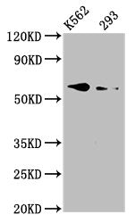 Western Blot  | Positive WB detected in: K562 whole cell lysate, 293 whole cell lysate  | All lanes: BMPR1A antibody at 3.3µg/ml  | Secondary  | Goat polyclonal to rabbit IgG at 1/50000 dilution  | Predicted band size: 61 kDa  | Observed band size: 61 kDa