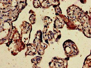 Immunohistochemistry of paraffin-embedded human placenta tissue using BMPR1B Antibody at dilution of 1:100