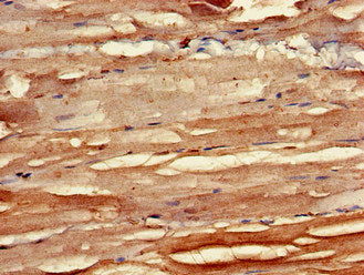 Immunohistochemistry of paraffin-embedded human skeletal muscle tissue using BMPR1B Antibody at dilution of 1:100