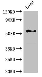 Western Blot | Positive WB detected in: Rat lung tissue | All lanes: BMPR1B antibody at 2.4μg/ml | Secondary | Goat polyclonal to rabbit IgG at 1/50000 dilution | Predicted band size: 57, 61 kDa | Observed band size: 57 kDa