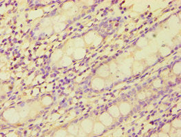 Immunohistochemistry of paraffin-embedded human colon tissue using BMX Antibody at dilution of 1:100