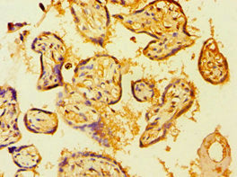 Immunohistochemistry of paraffin-embedded human placenta tissue using BMX Antibody at dilution of 1:100