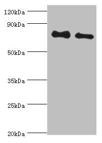Western blot | All lanes: Cytoplasmic tyrosine-protein kinase BMX antibody at 4μg/ml | Lane 1: A549 whole cell lysate | Lane 2: Mouse heart tissue | Secondary | Goat polyclonal to rabbit IgG at 1/10000 dilution | Predicted band size: 78 kDa | Observed band size: 78 kDa