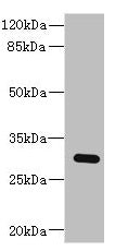 Western blot  | All lanes: BPGM antibody at 2.87µg/ml + Human placenta tissue  | Secondary  | Goat polyclonal to rabbit IgG at 1/10000 dilution  | Predicted band size: 30 kDa  | Observed band size: 30 kDa