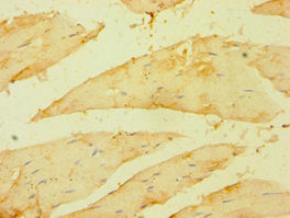 Immunohistochemistry of paraffin-embedded human skeletal muscle tissue using BRCC3 Antibody at dilution of 1:100