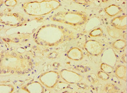 Immunohistochemistry of paraffin-embedded human kidney tissue using BRCC3 Antibody at dilution of 1:100