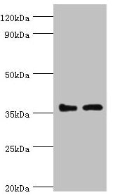 Western blot  | All lanes: BRCC3 antibody at 3μg/ml  | Lane 1: 293T whole cell lysate  | Lane 2: MCF-7 whole cell lysate  | Secondary  | Goat polyclonal to rabbit IgG at 1/10000 dilution  | Predicted band size: 37, 34, 24, 29 kDa  | Observed band size: 37 kDa