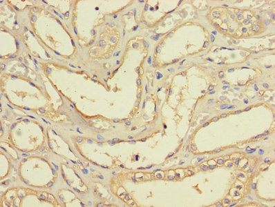 Immunohistochemistry of paraffin-embedded human kidney tissue using BRCC3 Antibody at dilution of 1:100