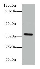 Western blot  | All lanes: BRCC3 antibody at 2µg/ml + K562 whole cell lysate  | Secondary  | Goat polyclonal to rabbit IgG at 1/15000 dilution  | Predicted band size: 37, 34, 24, 29 kDa  | Observed band size: 37 kDa