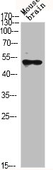 Western Blot analysis of MOUSE-BRAIN cells using GSK3β Polyclonal AntibodyRabbit anti-Human GSK3B Polyclonal Antibody