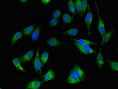 Immunofluorescent analysis of Hela cells using BTK Antibody at dilution of 1:100 and Alexa Fluor 488-congugated AffiniPure Goat Anti-Rabbit IgG(H+L)