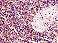 Immunohistochemistry of paraffin-embedded human spleen tissue using BTK Antibody at dilution of 1:100