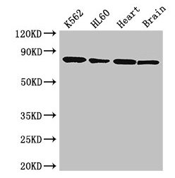 Western Blot  | Positive WB detected in: K562 whole cell lysate, HL60 whole cell lysate, Mouse heart tissue, Mouse brain tissue  | All lanes: BTK antibody at 3.5µg/ml  | Secondary  | Goat polyclonal to rabbit IgG at 1/50000 dilution  | Predicted band size: 77, 80 kDa  | Observed band size: 77 kDa