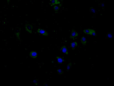 Immunofluorescence staining of Hela cell with BTN3A1 Antibody at 1:20, counter-stained with DAPI. The cells were fixed in 4% formaldehyde and blocked in 10% normal Goat Serum. The cells were then incubated with the antibody overnight at 4C. The secondary antibody was Alexa Fluor 488-congugated AffiniPure Goat Anti-Rabbit IgG(H+L).Rabbit anti-Human BTN3A1 Polyclonal Antibody