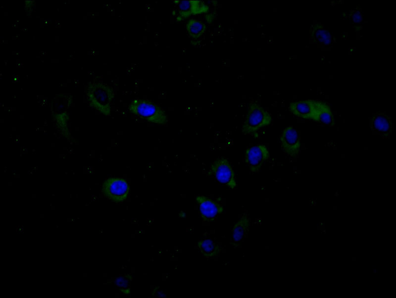 Immunofluorescence staining of Hela cell with BTN3A1 Antibody at 1:20, counter-stained with DAPI. The cells were fixed in 4% formaldehyde and blocked in 10% normal Goat Serum. The cells were then incubated with the antibody overnight at 4C. The secondary antibody was Alexa Fluor 488-congugated AffiniPure Goat Anti-Rabbit IgG(H+L).Rabbit anti-Human BTN3A1 Polyclonal Antibody