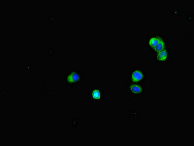 Immunofluorescent analysis of HepG2 cells using BUB1B Antibody at dilution of 1:100 and Alexa Fluor 488-congugated AffiniPure Goat Anti-Rabbit IgG(H+L)