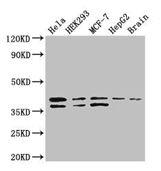 Western Blot | Positive WB detected in: Hela whole cell lysate, HEK293 whole cell lysate, MCF-7 whole cell lysate, HepG2 whole cell lysate, Mouse brain tissue | All lanes: BUB3 antibody at 3.4μg/ml | Secondary | Goat polyclonal to rabbit IgG at 1/50000 dilution | Predicted band size: 38, 37 kDa | Observed band size: 38, 37 kDa