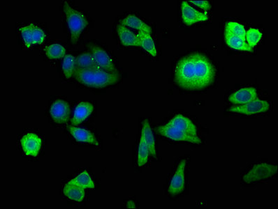 Immunofluorescence staining of HepG2 cells with FUOM Antibody at 1:140, counter-stained with DAPI. The cells were fixed in 4% formaldehyde, permeabilized using 0.2% Triton X-100 and blocked in 10% normal Goat Serum. The cells were then incubated with the antibody overnight at 4°C. The secondary antibody was Alexa Fluor 488-congugated AffiniPure Goat Anti-Rabbit IgG(H+L).Rabbit anti-Human FUOM Polyclonal Antibody