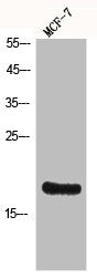 Western Blot analysis of MCF7 cells using Histone H3 Polyclonal AntibodyRabbit anti-Human Histone H3 Polyclonal Antibody