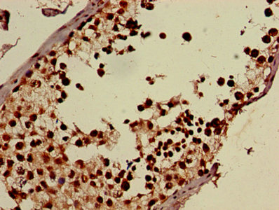 Immunohistochemistry of paraffin-embedded human testis tissue using DDX39B Antibody at dilution of 1:100Rabbit anti-Human DDX39B Polyclonal Antibody