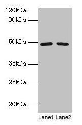 Western blot  | All lanes: DDX39B antibody at 2µg/ml  | Lane 1: EC109 whole cell lysate  | Lane 2: 293T whole cell lysate  | Secondary  | Goat polyclonal to rabbit IgG at 1/15000 dilution  | Predicted band size: 49, 51 kDa  | Observed band size: 49 kDaRabbit anti-Human DDX39B Polyclonal Antibody