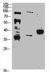 Western Blot analysis of 293 K562 HELA cells using IκB-α Polyclonal AntibodyRabbit anti-Human NFKBIA Polyclonal Antibody