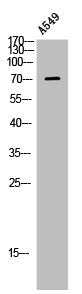 Western Blot analysis of A549 using LIMK-1 Polyclonal Antibody.