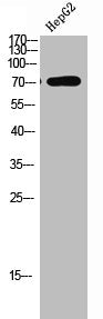 Western Blot analysis of HEPG2 using LIMK-1/2 Polyclonal Antibody.Rabbit anti-Human LIMK1/LIMK2 Polyclonal Antibody