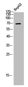 Western Blot analysis of HEPG2 using LIMK-1/2 Polyclonal Antibody.Rabbit anti-Human LIMK1/LIMK2 Polyclonal Antibody