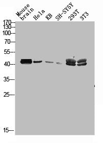 Western blot analysis of mouse-brain HELA KB SH-SY5Y 293T 3T3 lysis using MAGE-C2 antibody.
