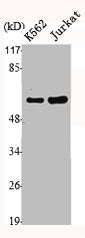 Western Blot analysis of Jurkat K562 cells using MMP-1 Polyclonal AntibodyRabbit anti-Human MMP1 Polyclonal Antibody