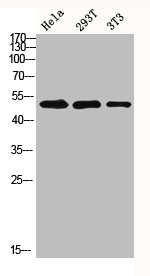 Western blot analysis of HELA 293T 3T3 lysis using MMP-1 antibody.Rabbit anti-Human MMP1 Polyclonal Antibody