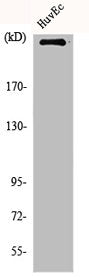 Western Blot analysis of HuvEc cells using mTOR Polyclonal AntibodyRabbit anti-Human MTOR Polyclonal Antibody