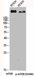 Western Blot analysis of HY926 cells using mTOR Polyclonal AntibodyRabbit anti-Human MTOR Polyclonal Antibody