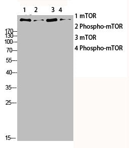 Western blot analysis of customer's lysis using mTOR antibody.Rabbit anti-Human MTOR Polyclonal Antibody