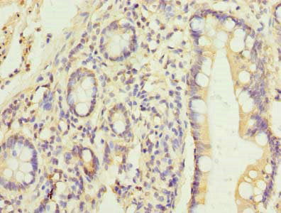 Immunohistochemistry of paraffin-embedded human small intestine tissue using HEATR9 Antibody at dilution of 1:100Rabbit anti-Human HEATR9 Polyclonal Antibody