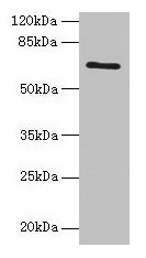 Western blot  | All lanes: HEATR9 antibody at 1.2µg/ml + Jurkat whole cell lysate  | Secondary  | Goat polyclonal to rabbit IgG at 1/10000 dilution  | Predicted band size: 66, 27, 61, 45, 40 kDa  | Observed band size: 66 kDaRabbit anti-Human HEATR9 Polyclonal Antibody