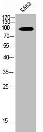 Western Blot analysis of K562 cells using NFκB-p100 Polyclonal AntibodyRabbit anti-Human NFKB2 Polyclonal Antibody