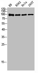 Western blot analysis of KB K562 Hela 293T lysis using NFκB-p100 antibody.Rabbit anti-Human NFKB2 Polyclonal Antibody