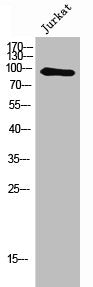 Western Blot analysis of Jurkat cells using NFκB-p100 Polyclonal AntibodyRabbit anti-Human NFKB2 Polyclonal Antibody