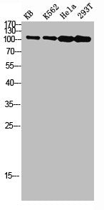 Western blot analysis of KB K562 Hela 293T lysis using NFκB-p100 antibody.Rabbit anti-Human NFKB2 Polyclonal Antibody